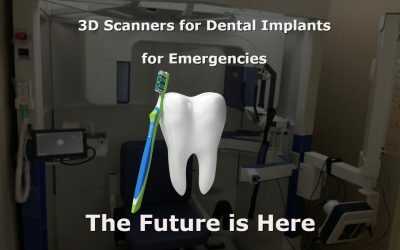 3d Scans For Dental Emergencies