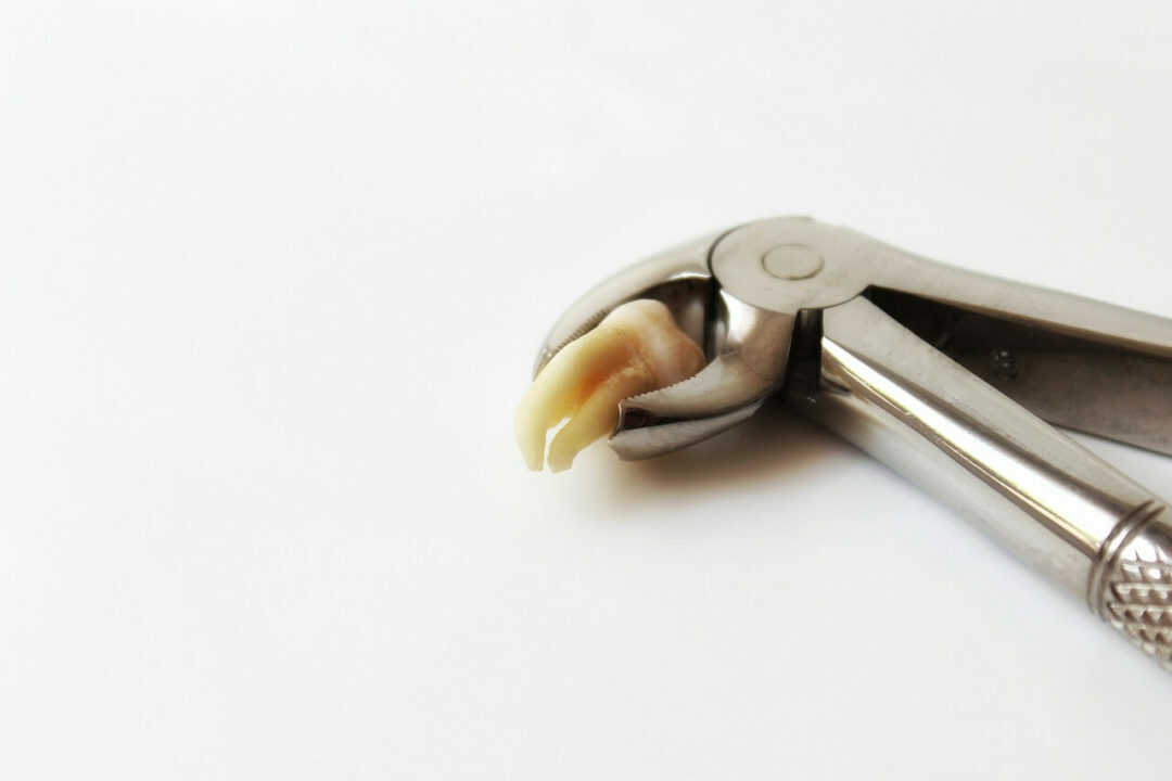 Emergency Tooth Extraction Near Me Emergency Dentist *! Call 24/7